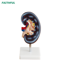 Modelo de rim da série XC-310