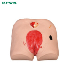 Modelo de Cuidados com Ulcer Cuidados de Decúbito XC-459